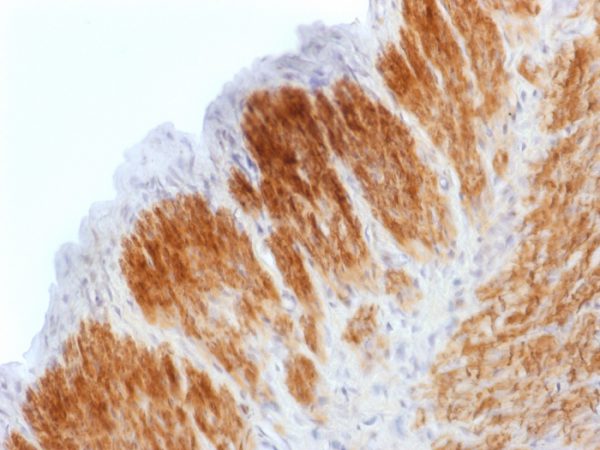 Formalin-fixed, paraffin-embedded Rat Uterus stained with Calponin Rabbit Recombinant Monoclonal Antibody (CNN1/1408R).