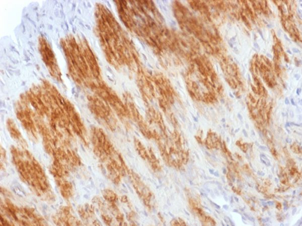 Formalin-fixed, paraffin-embedded Rat Uterus stained with Calponin Rabbit Polyclonal Antibody