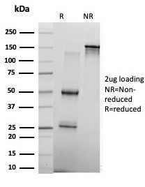 SDS-PAGE Analysis Purified KLF17 Mouse Monoclonal Antibody (PCRP-KLF17-1G2). Confirmation of Purity and Integrity of Antibody.