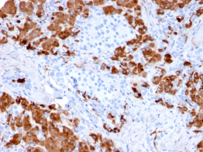 Formalin-fixed, paraffin-embedded human Pancreas stained with Carboxypeptidase A1 / CPA1 Mouse Monoclonal Antibody (CPA1/2712). Carboxypeptidase A1 / CPA1 (Pancreatic Cancer Marker) Antibody - Image 2