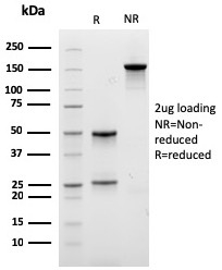 SDS-PAGE Analysis Purified Carboxypeptidase A1 / CPA1 Mouse Monoclonal Antibody (CPA1/2712). Confirmation of Purity and Integrity of Antibody Carboxypeptidase A1 / CPA1 (Pancreatic Cancer Marker) Antibody - Image 3
