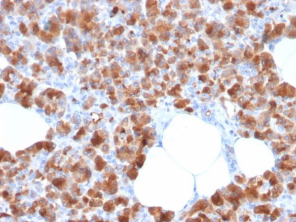 Formalin-fixed, paraffin-embedded human Pancreas stained with Carboxypeptidase A1 / CPA1 Mouse Monoclonal Antibody (CPA1/2713).
