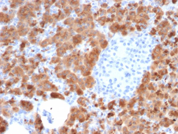 Formalin-fixed, paraffin-embedded human Pancreas stained with Carboxypeptidase A1 / CPA1 Mouse Monoclonal Antibody (CPA1/2714).