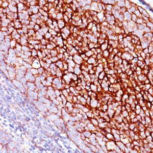Formalin-fixed, paraffin-embedded human Tonsil stained with CD35 Mouse Monoclonal Antibody (E11).