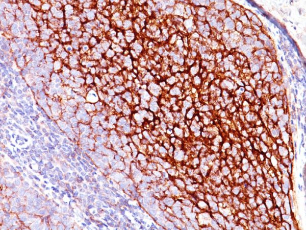Formalin-fixed, paraffin-embedded human Tonsil stained with CD35 Mouse Monoclonal Antibody (E11).