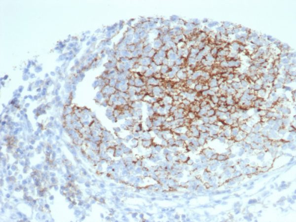 Formalin-fixed, paraffin-embedded human tonsil stained with CD35 Mouse Monoclonal Antibody (CR1/6383) at 2ug/ml.