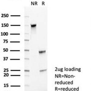 SDS-PAGE Analysis of Purified CD35 Mouse Monoclonal Antibody (CR1/6385). Confirmation of Purity and Integrity of Antibody.