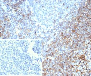 Formalin-fixed, paraffin-embedded human tonsil stained with CD35 Recombinant Mouse Monoclonal Antibody (rCR1/7289) at 2ug/ml. Inset: PBS instead of primary antibody; secondary only negative control.