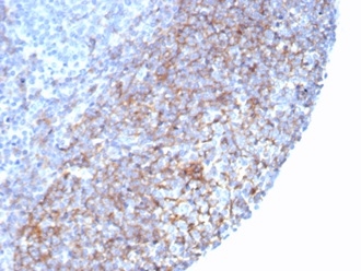 Formalin-fixed, paraffin-embedded human tonsil stained with CD35 Recombinant Mouse Monoclonal Antibody (rCR1/7289) at 2ug/ml. HIER: Tris/EDTA, pH9.0, 45min. 2 °: HRP-polymer, 30min. DAB, 5min.