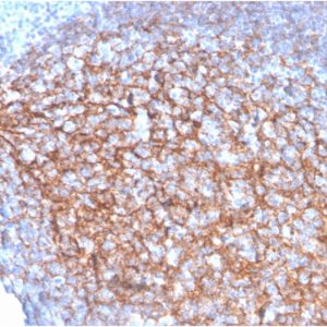 Formalin-fixed, paraffin-embedded human Tonsil stained with CD35 Mouse Monoclonal Antibody (SPM554).