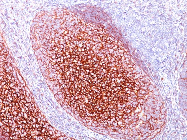 Formalin-fixed, paraffin-embedded human Tonsil stained with CD35 Mouse Monoclonal Antibody (CR1/802).