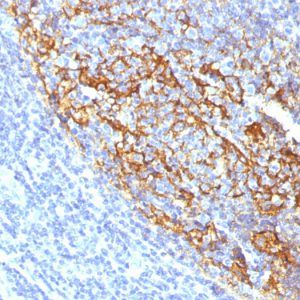 Formalin-fixed, paraffin-embedded human Tonsil stained with CD35 Mouse Monoclonal Antibody (To5).