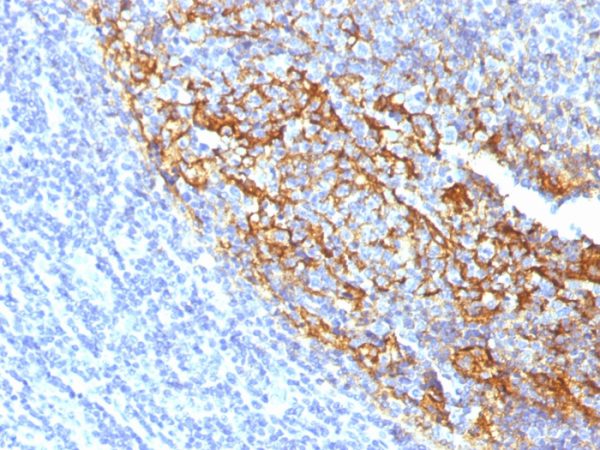 Formalin-fixed, paraffin-embedded human Tonsil stained with CD35 Mouse Monoclonal Antibody (To5).