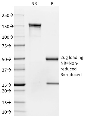 SDS-PAGE AnalysisPurified CD35 Mouse Monoclonal Antibody (To5). Confirmation of Integrity and Purity of Antibody.