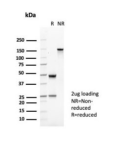 SDS-PAGE Analysis of Purified CD35 Mouse Monoclonal Antibody (CR1/6377). Confirmation of Purity and Integrity of Antibody.