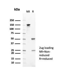 SDS-PAGE Analysis of Purified CD35 Mouse Monoclonal Antibody (CR1/6378). Confirmation of Purity and Integrity of Antibody.