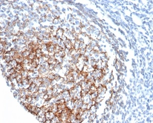 Formalin-fixed, paraffin-embedded human tonsil stained with CD35 Mouse Monoclonal Antibody (CR1/6378) at 2ug/ml. HIER: Tris/EDTA, pH9.0, 45min. 2°C: HRP-polymer, 30min. DAB, 5min.
