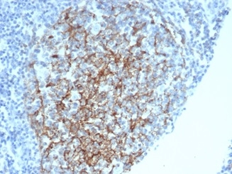Formalin-fixed, paraffin-embedded human spleen stained with CD35 Mouse Monoclonal Antibody (CR1/6378) at 2ug/ml. HIER: Tris/EDTA, pH9.0, 45min. 2°C: HRP-polymer, 30min. DAB, 5min.