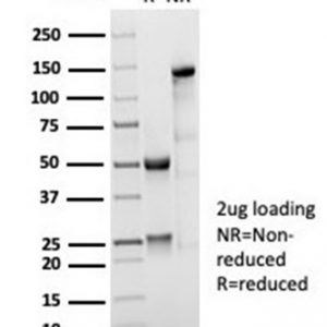SDS-PAGE Analysis of Purified CD35 Recombinant Rabbit Monoclonal Antibody (CD35/7016R). Confirmation of Purity and Integrity of Antibody.