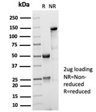 SDS-PAGE Analysis Purified CD35 Recombinant Rabbit Monoclonal Antibody (CD35/7016R). Confirmation of Purity and Integrity of Antibody.