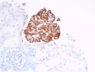 Formalin-fixed, paraffin-embedded human kidney stained with CD35 Recombinant Rabbit Monoclonal Antibody (CD35/7016R) at 2ug/ml. Inset: PBS instead of primary antibody; secondary only negative control.