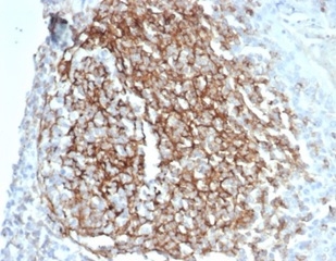 Formalin-fixed, paraffin-embedded human kidney stained with CD35 Recombinant Rabbit Monoclonal Antibody (CD35/7016R) at 2ug/ml. HIER: Tris/EDTA, pH9.0, 45min. 2 °: HRP-polymer, 30min. DAB, 5min.