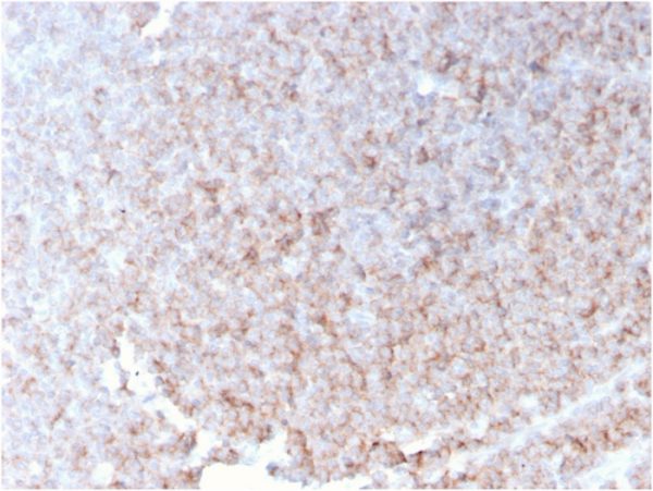 Formalin-fixed, paraffin-embedded human spleen stained with CD21 Recombinant Mouse Monoclonal Antibody (rCR2/1952).