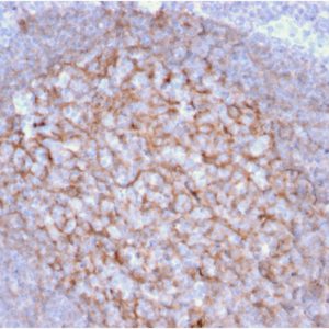 Formalin-fixed, paraffin-embedded human Tonsil stained with CD21 / CR2 Mouse Monoclonal Antibody (CR2/1953).