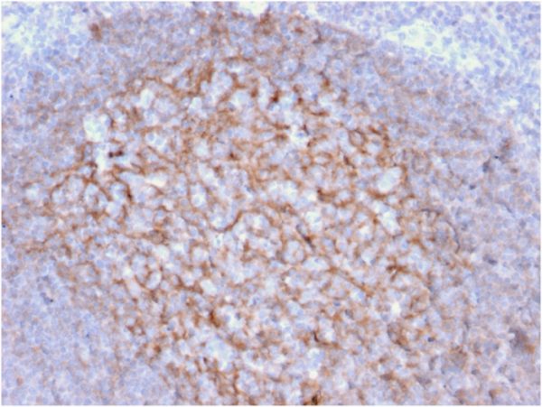 Formalin-fixed, paraffin-embedded human Tonsil stained with CD21 / CR2 Mouse Monoclonal Antibody (CR2/1953).