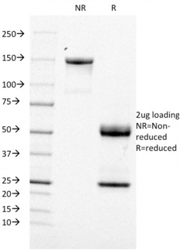 SDS-PAGE Analysis Purified CD21 / CR2 Mouse Monoclonal Antibody (CR2/1953). Confirmation of Purity and Integrity of Antibody.