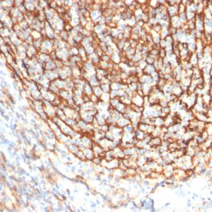 Formalin-fixed, paraffin-embedded Human Tonsil Dendritic stained with CD21-Monospecific Mouse Monoclonal Antibody (CR2/2754).
