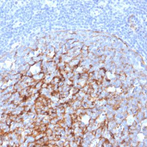Formalin-fixed, paraffin-embedded human Tonsil stained with CD21-Monospecific Mouse Monoclonal Antibody (CR2/3247).