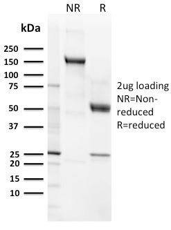 SDS-PAGE Analysis Purified CD21 / CR2 Recombinant Rabbit Monoclonal Antibody (CR2/3124R). Confirmation of Purity and Integrity of Antibody.