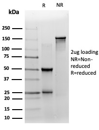 SDS-PAGE Analysis of Purified ZNF358 Mouse Monoclonal Antibody (PCRP-ZNF358-1A6). Confirmation of Purity and Integrity of Antibody.
