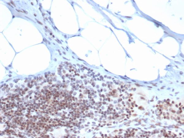Formalin-fixed, paraffin-embedded human tonsil stained with ZBTB46 Mouse Monoclonal Antibody (PCRP-ZBTB46-2B8).