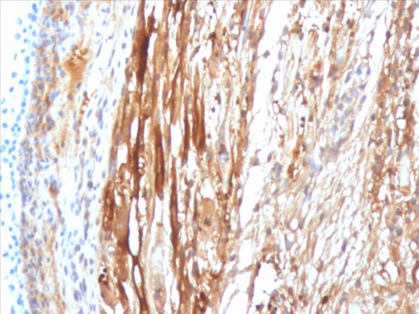 Formalin-fixed, paraffin-embedded Rat Heart Muscle stained with Crystallin Alpha B Mouse Monoclonal Antibody (CPTC-CYRAB-1).