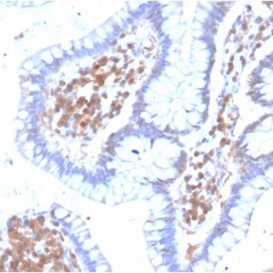 Formalin-fixed, paraffin-embedded human Colon stained with MAPK14 Mouse Monoclonal Antibody (CPTC-MAPK14-1).