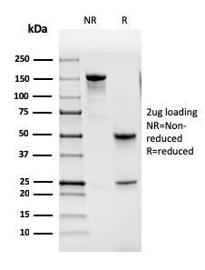 SDS-PAGE Analysis Purified GM-CSF Mouse Monoclonal Antibody (CSF2/3402). Confirmation of Purity and Integrity of Antibody.