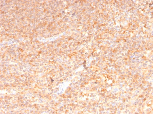 Formalin-fixed, paraffin-embedded human spleen stained with GM-CSF Mouse Monoclonal Antibody (CSF2/3402).