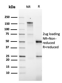 SDS-PAGE Analysis Purified GM-CSF Mouse Monoclonal Antibody (CSF2/3403). Confirmation of Purity and Integrity of Antibody.