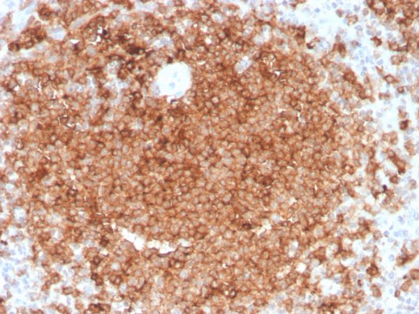 Formalin-fixed, paraffin-embedded human spleen stained with GM-CSF Mouse Monoclonal Antibody (CSF2/3403).