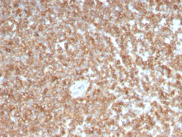 Formalin-fixed, paraffin-embedded human spleen stained with GM-CSF Mouse Monoclonal Antibody (CSF2/3403).