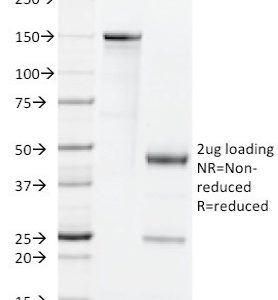SDS-PAGE Analysis of Purified GM-CSF Rat Monoclonal Antibody (BVD2-21C11). Confirmation of Purity and Integrity of Antibody.