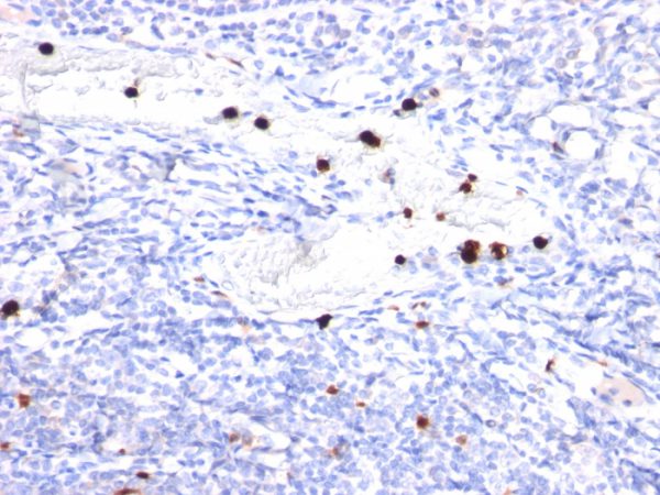 Formalin-fixed, paraffin-embedded human Tonsil stained with G-CSF Mouse Monoclonal Antibody (CSF3/900).