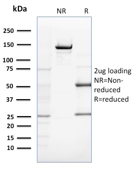 SDS-PAGE Analysis Purified ZNF690 / ZSCAN29 Mouse Monoclonal Antibody (ZSCAN29/2610). Confirmation of Purity and Integrity of Antibody.