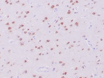 Formalin-fixed, paraffin-embedded human cerebrum stained with NeuN Recombinant Rabbit Monoclonal Antibody (NeuN/288R). HIER: Tris/EDTA, pH9.0, 45min. 2°C: HRP-polymer, 30min. DAB, 5min.