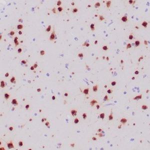 Formalin-fixed, paraffin-embedded human ganglioma stained with NeuN Recombinant Rabbit Monoclonal Antibody (NeuN/6694R).