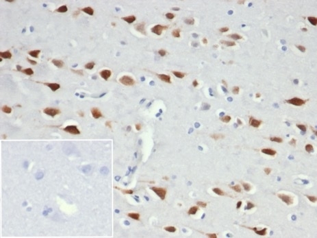 Formalin-fixed, paraffin-embedded human brain stained with NeuN Recombinant Rabbit Monoclonal Antibody (NeuN/6694R).