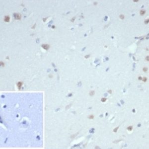 Formalin-fixed, paraffin-embedded humancerebellumstained with NeuN Recombinant Rabbit Monoclonal Antibody (NeuN/7071R).