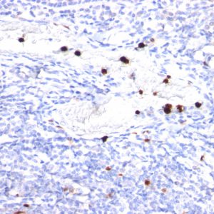 Formalin-fixed, paraffin-embedded human Tonsil stained with Cystatin A Mouse Monoclonal Antibody (CPTC-CSTA-1).